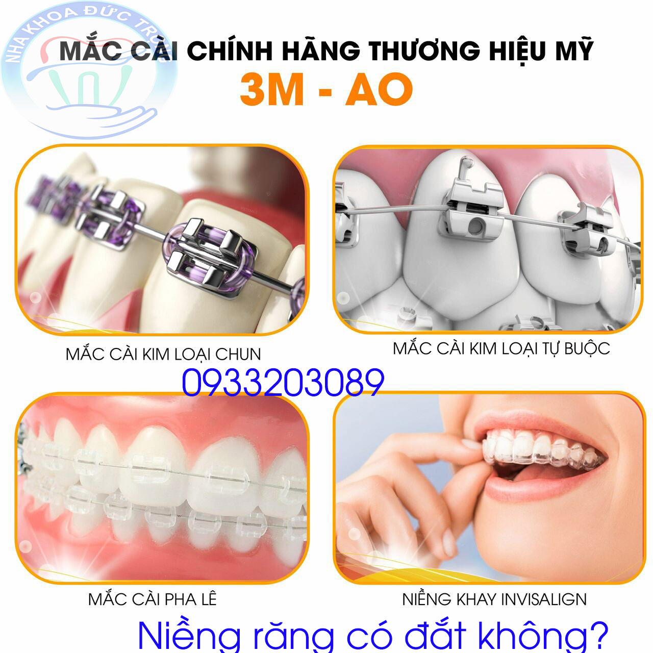 Trường hợp nào lên chỉnh nha - niềng răng? Chỉnh nha - niềng răng Thủy Nguyên
